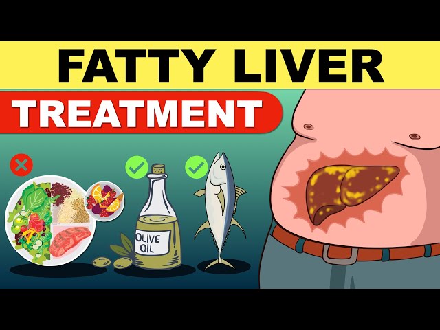 Fatty Liver – Causes, Symptoms & Natural Remedies