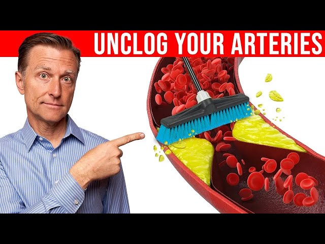 Natural Ways to Prevent Heart Blockage | Heart Health Tips